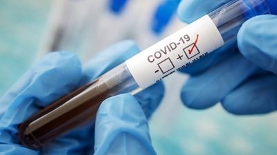 Рекордні показники захворювання на СOVID-19: на Херсонщині +322 , в Україні - понад 13 тисяч