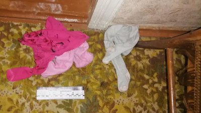 На Миколаївщині чоловік облив співмешканку та її дітей хімічною речовиною На Миколаївщині чоловік облив співмешканку та її дітей хімічною речовиною