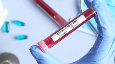 COVID-19: за добу на Херсонщині виявили 192 нові випадки, в Україні +9397