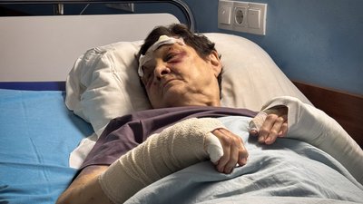 Обстріл Запоріжжя: історія літньої жінки, яка понад годину провела у палаючому будинку