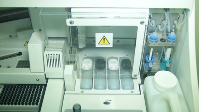 У Вінниці почали робити життєво-необхідний аналіз для людей із донорськими органами У Вінниці почали робити життєво-необхідний аналіз для людей із донорськими органами