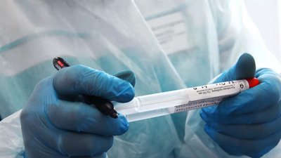 За минулу добу коронавірус виявили у 55 жителів Сумщини (ОНОВЛЕНЕ)