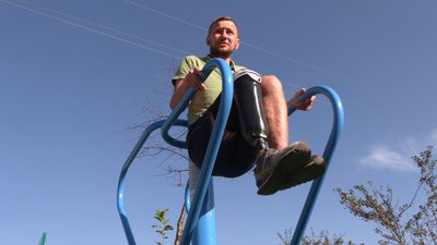 Протезування військових