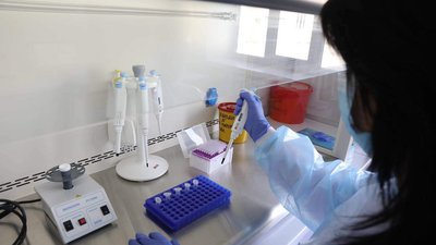 У МОЗ нагадали, де можна пройти тест на ВІЛ і гепатити