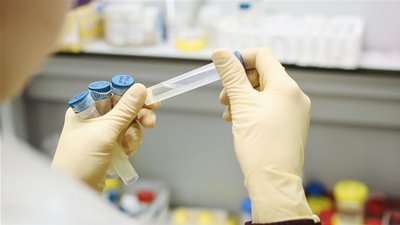 На Чернігівщині 398 людей захворіли на коронавірус, 163 одужали та шестеро померли