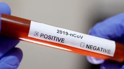 COVID-19: за добу на Херсонщині виявили 316 нових випадків