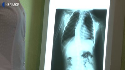 В Україні припинять працювати санаторні школи-інтернати