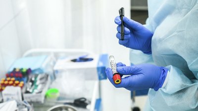 У Сумській області коронавірусом інфікувалися ще 229 людей