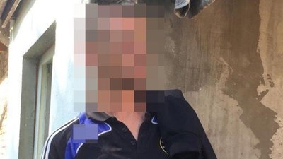 Побили до коми: дві жінки та чоловік напали на лучанина. Жінок розшукують