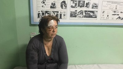 Рвані рани, контузії та переломи: в якому стані поранені під час ракетного удару по Сергіївці на Одещині. ВІДЕО