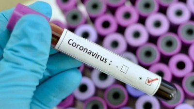 За добу на Херсонщині виявили 67 нових випадків COVID-19, 1 людина померла