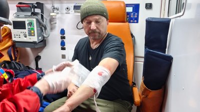 Поранений журналіст Ігор Левенок в Краматорську