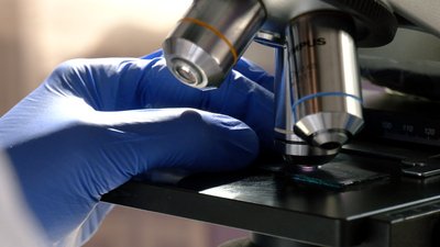 Лікується 400 людей: ситуація із туберкульозом на Черкащині Лікується 400 людей: ситуація із туберкульозом на Черкащині