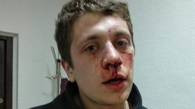 У Дніпрі невідомі побили громадського активіста Мельничука