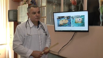 У Полтаві хірурги зробили операції на легенях за новим методом У Полтаві хірурги зробили операції на легенях за новим методом