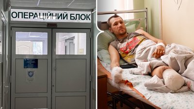 Перші випадки обмороження: у Кропивницькому лікують трьох людей