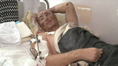 "Усі злагоджені, бо це "нуль". Що розповідають добровольці, які лікуються на Сумщині "Усі злагоджені, бо це "нуль". Що розповідають добровольці, які лікуються на Сумщині
