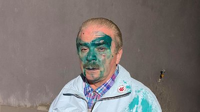 Поліцейські розшукують чоловіка, який облив зеленкою кандидата на посаду міського голови Тернополя