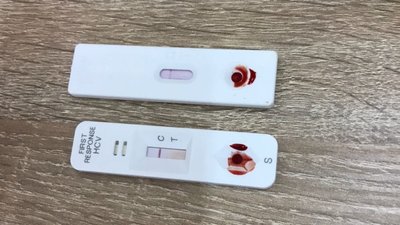 У Кропивницькому безкоштовно та анонімно тестують на ВІЛ та гепатит С У Кропивницькому безкоштовно та анонімно тестують на ВІЛ та гепатит С