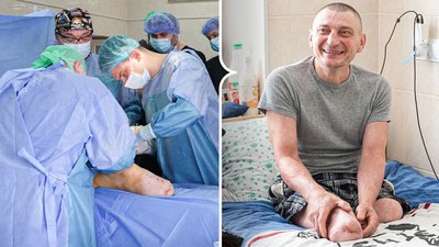 Колаж: Операція з остеоінтеграції, Олександр — військовослужбовець