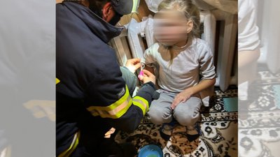 У Черкасах рятувальники допомогли дитині, у якої рука застрягла в радіаторі системи опалення
