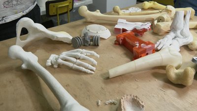 В Івано-Франківську створюють протези за технологією 3D-друку В Івано-Франківську створюють протези за технологією 3D-друку