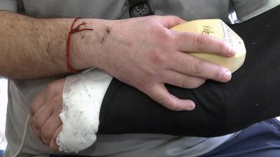 "Вже можу називати себе військовим з досвідом", – історія бійця, який лікується після поранення на Волині "Вже можу називати себе військовим з досвідом", – історія бійця, який лікується після поранення на Волині