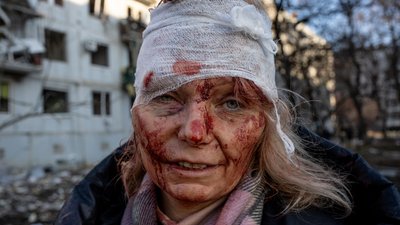 Була на сторінках світових ЗМІ після знімку 24 лютого: чому жителька Чугуєва повернулася з-за кордону Була на сторінках світових ЗМІ після знімку 24 лютого: чому жителька Чугуєва повернулася з-за кордону