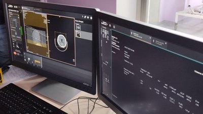 Новий комп'ютерний томограф вартістю один мільйон доларів випробовують в обласній лікарні у Житомирі Новий комп'ютерний томограф вартістю один мільйон доларів випробовують в обласній лікарні у Житомирі