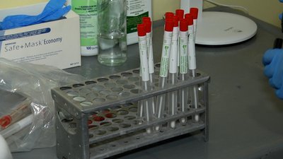 У Житомирі запрацював оновлений центр забору проб на ПЛР-тестування У Житомирі запрацював оновлений центр забору проб на ПЛР-тестування