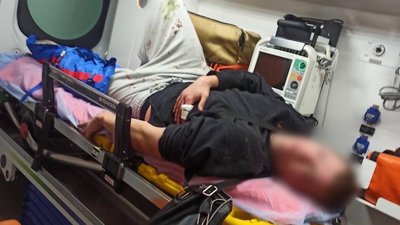 Підозрюваний у нападі, який намагався втекти, але впав і зламав ногу