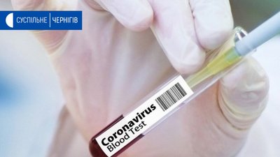 За минулу добу на Чернігівщині виявили 13 нових хворих на коронавірус