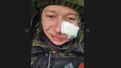Лідера гурту "Бумбокс" поранено під час обстрілу