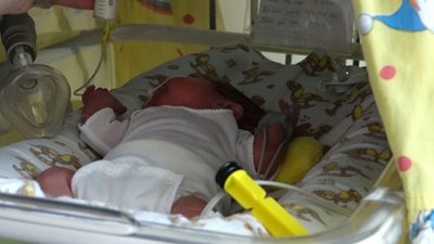 750-грамовий малюк народився у Житомирі і його врятували лікарі
