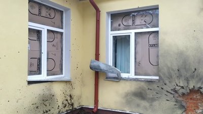 Радіологічне відділення Чернігівського центру сучасної онкології після вторгення росії в Україну Радіологічне відділення Чернігівського центру сучасної онкології після вторгення росії в Україну