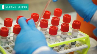 18 одужали, 22 захворіли: дані за добу про COVID-19 на Вінниччині