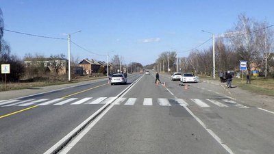 ДТП, аварія, самокат, дитина, реанімація, поліція, міжнародна траса