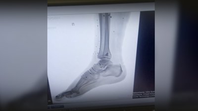 Відмовляються покидати господарство: у селі Єліне, що на Чернігівщині за 4 км від Росії, залишилося двоє жителів Відмовляються покидати господарство: у селі Єліне, що на Чернігівщині за 4 км від Росії, залишилося двоє жителів