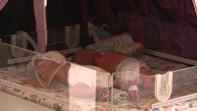 Новонародженій четвірні в Ужгороді дали імена Новонародженій четвірні в Ужгороді дали імена