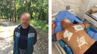 У Черкасах сталась стрілянина через конфлікт між чоловіками