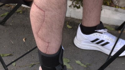 Державна програма для військовослужбовців "Медевак" Державна програма для військовослужбовців "Медевак"