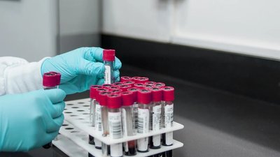 Які тести на COVID-19 є в Миколаївській області та кому їх роблять? Пояснює заступниця начальника УОЗ