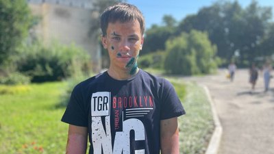 "Ма, я хочу жити, спаси": чому на Сумщині не ремонтують під'їзд до дитячої обласної лікарні "Ма, я хочу жити, спаси": чому на Сумщині не ремонтують під'їзд до дитячої обласної лікарні