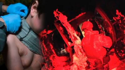 Евакуація пораненого 14-річного хлопчика: як це відбувалося, розповів прикордонник