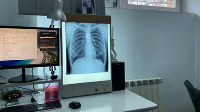 Мобільні рентген-кабінети придбали для Центру легеневих хвороб в Ужгороді Мобільні рентген-кабінети придбали для Центру легеневих хвороб в Ужгороді
