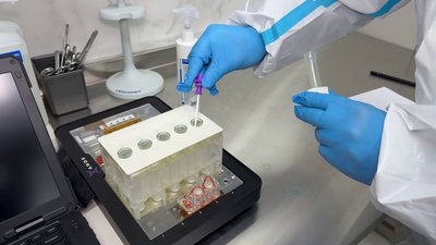 Зразки ДНК перекладають у пробірки