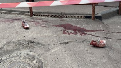 У Сумах чоловіка поранили ножем у ході сварки, 27 квітня 2027 року