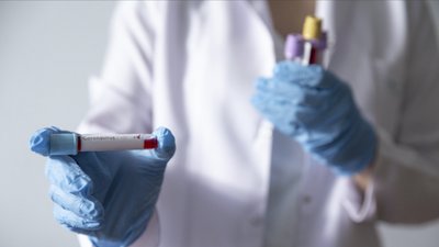 Новий рекорд: на Чернігівщині 212 людей захворіли на Covid-19