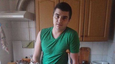 22-річний маріуполець після ампутації ноги, через обстріл російських військових, проходить реабілітацію у Запоріжжі