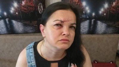 У Сумах побили керівницю благодійного фонду. Що відомо